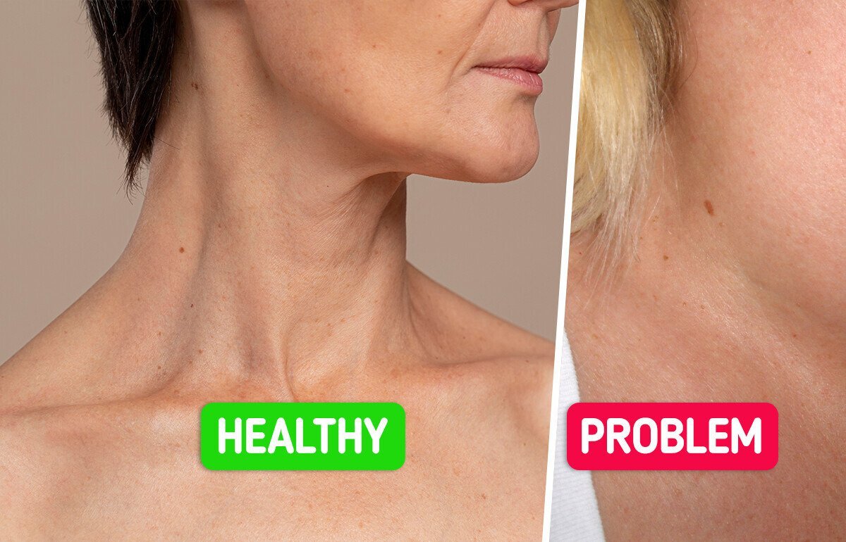 6 Warning Signs Your Thyroid Might Be in Trouble