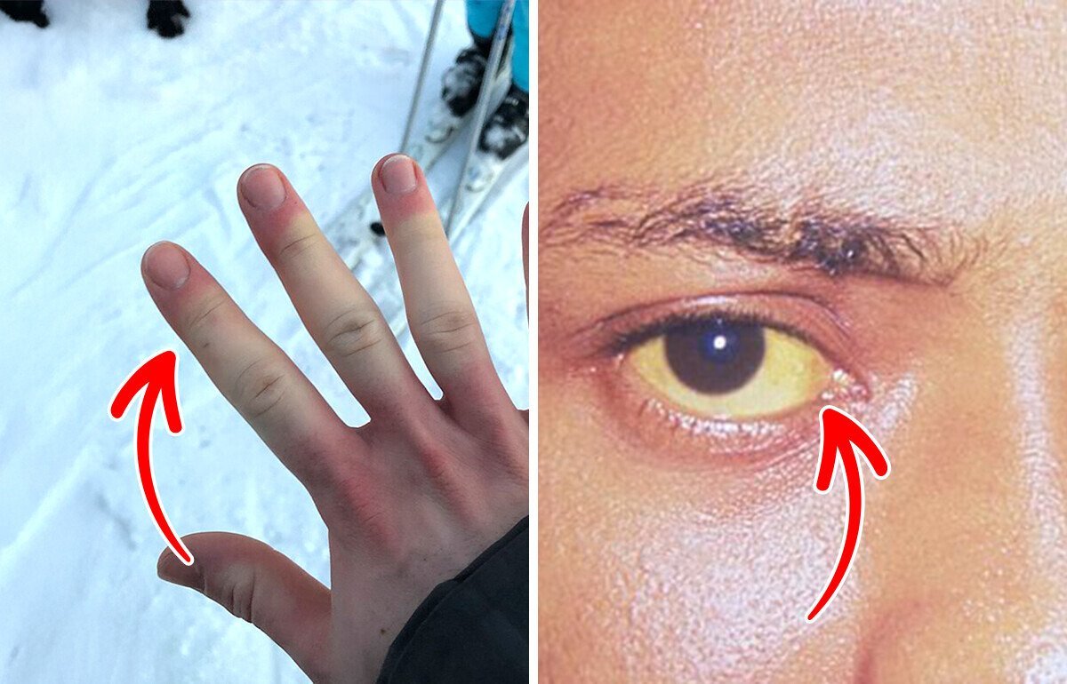 8 Silent Red Flags Your Immune System Is Struggling