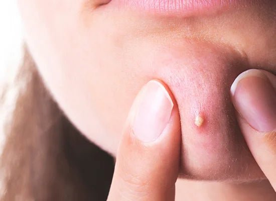 What Your Face Reveals About Your Health