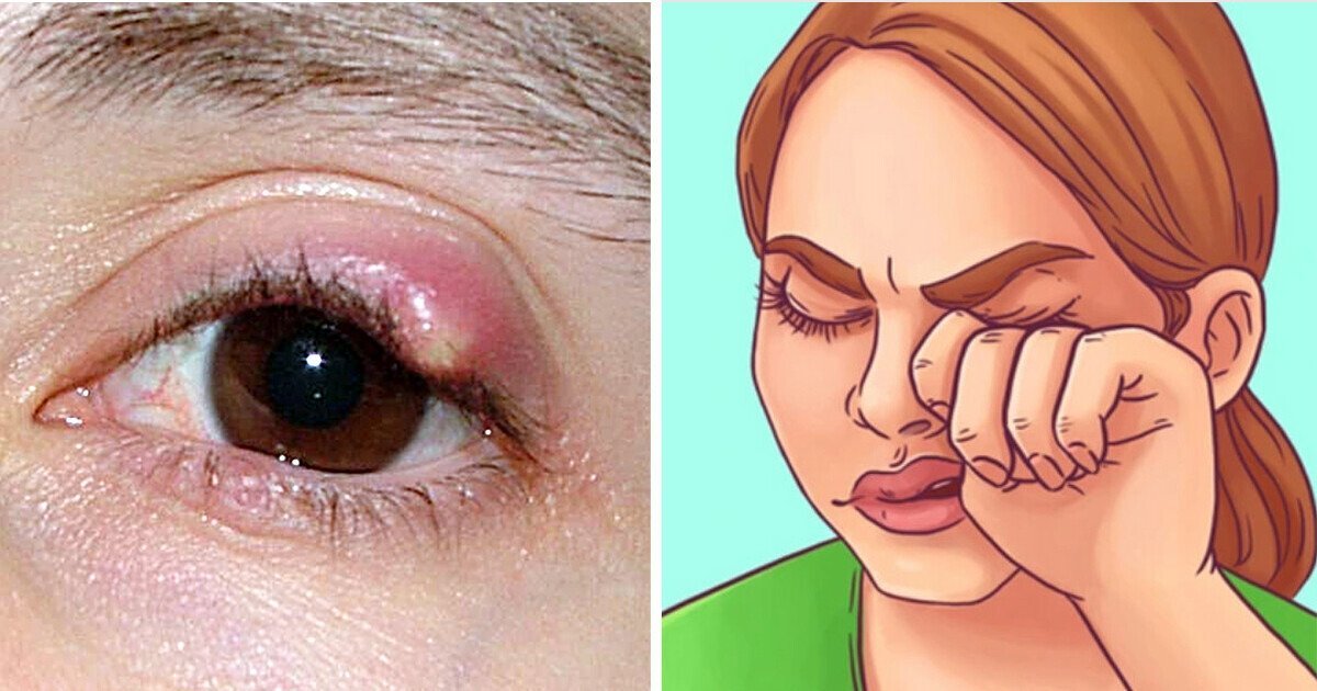 10 Health Signs Your Eyes Might Reveal About Your Body